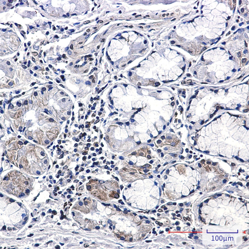 CSDE1 Rabbit mAb