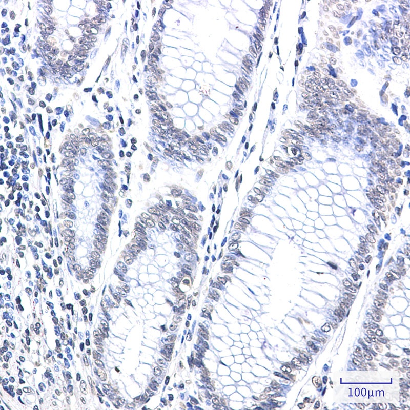 CPS1 Rabbit mAb