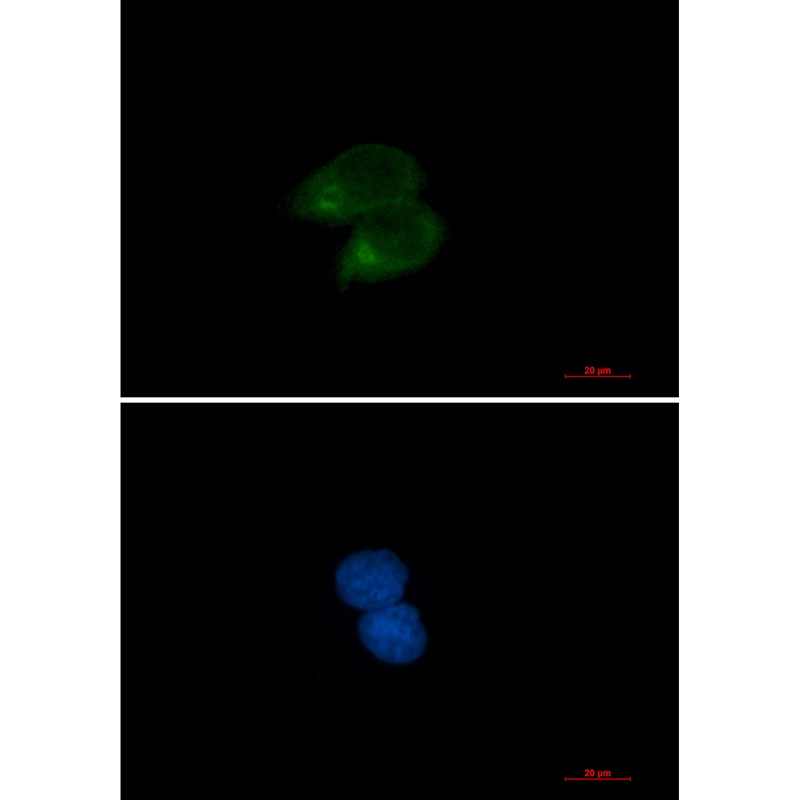 CLSTN1 Rabbit mAb