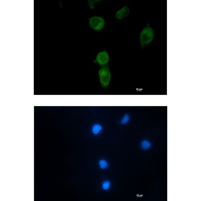 CLPX Rabbit mAb