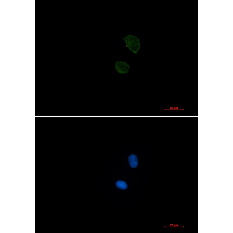 CD99 Rabbit mAb