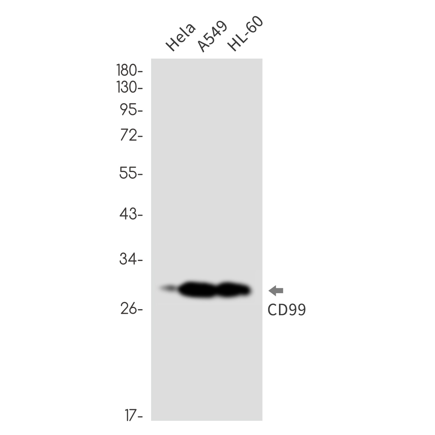 CD99 Rabbit mAb