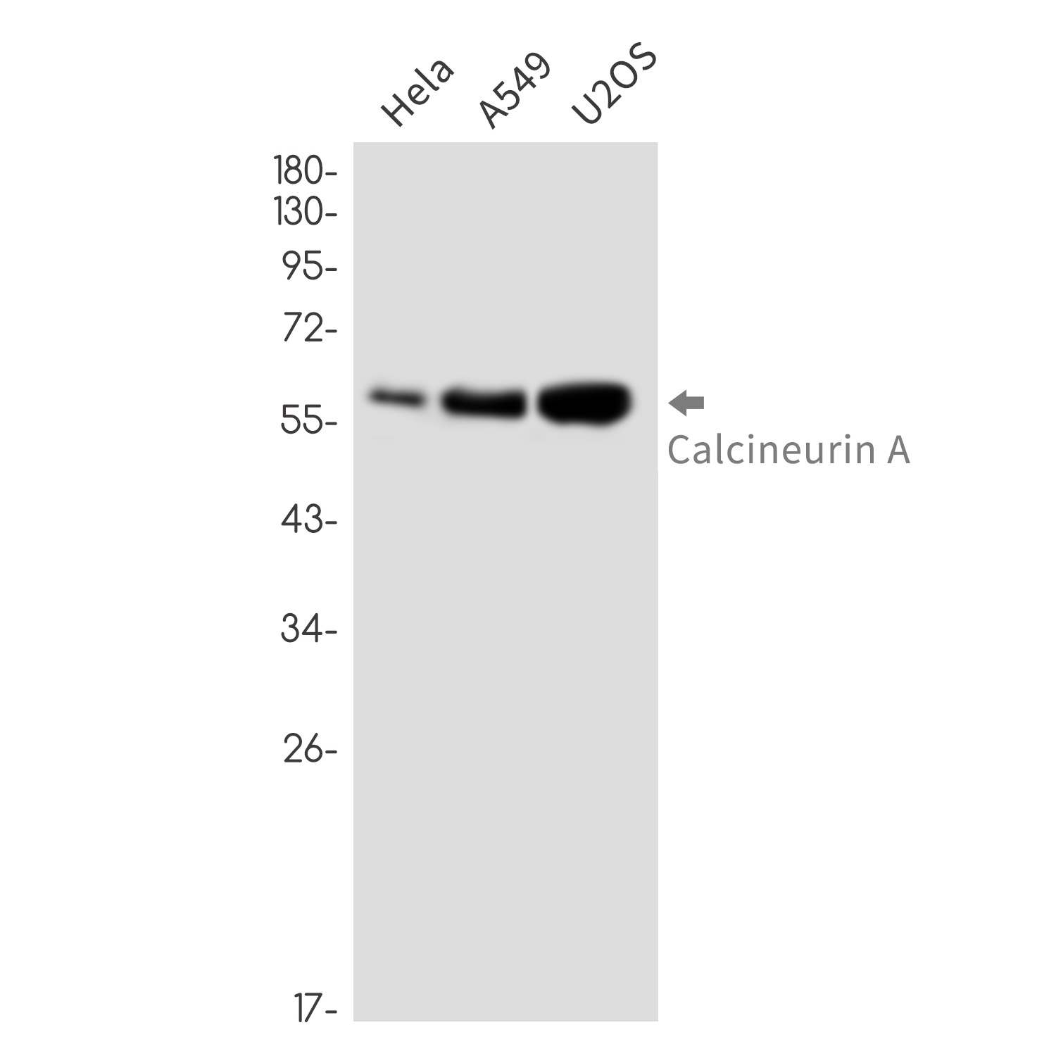 Calcineurin A Rabbit mAb