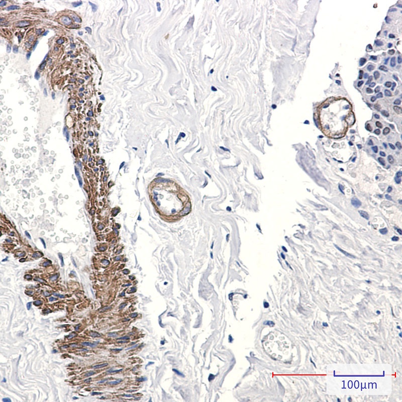 Transcription Factor AP 2 gamma Rabbit mAb