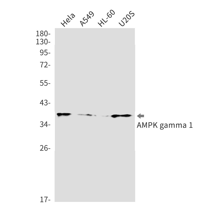 AMPK gamma 1 Rabbit mAb