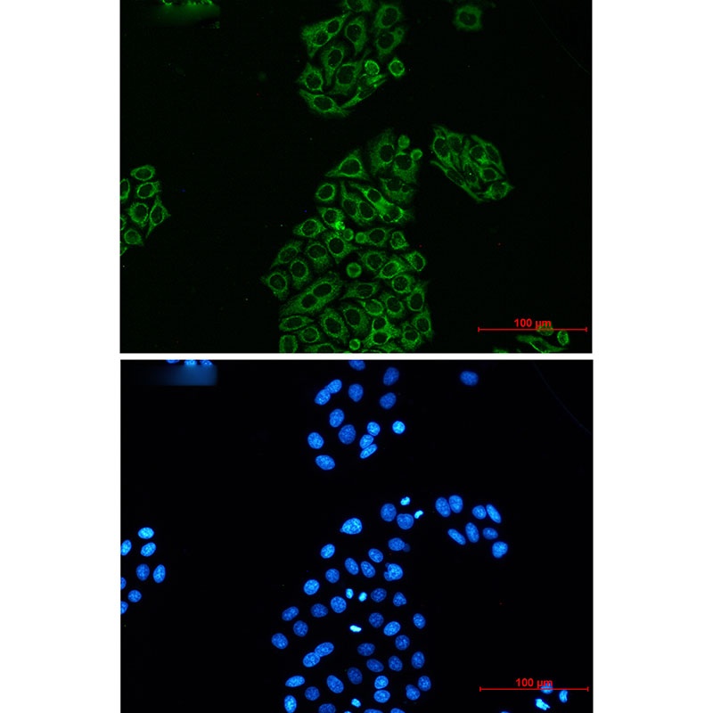 AK2 Rabbit mAb