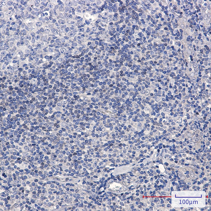 ADK Rabbit mAb