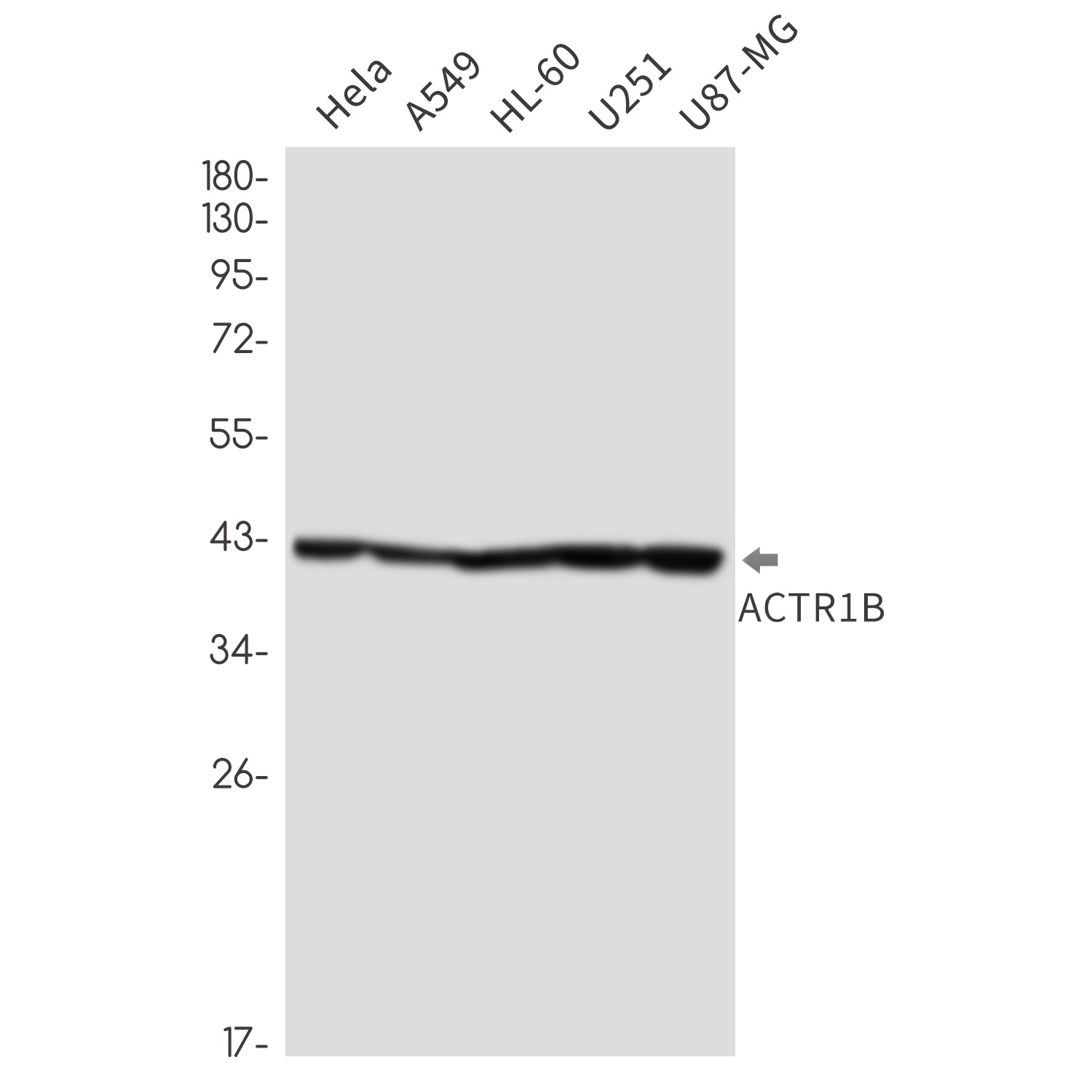 ACTR1B Antibody