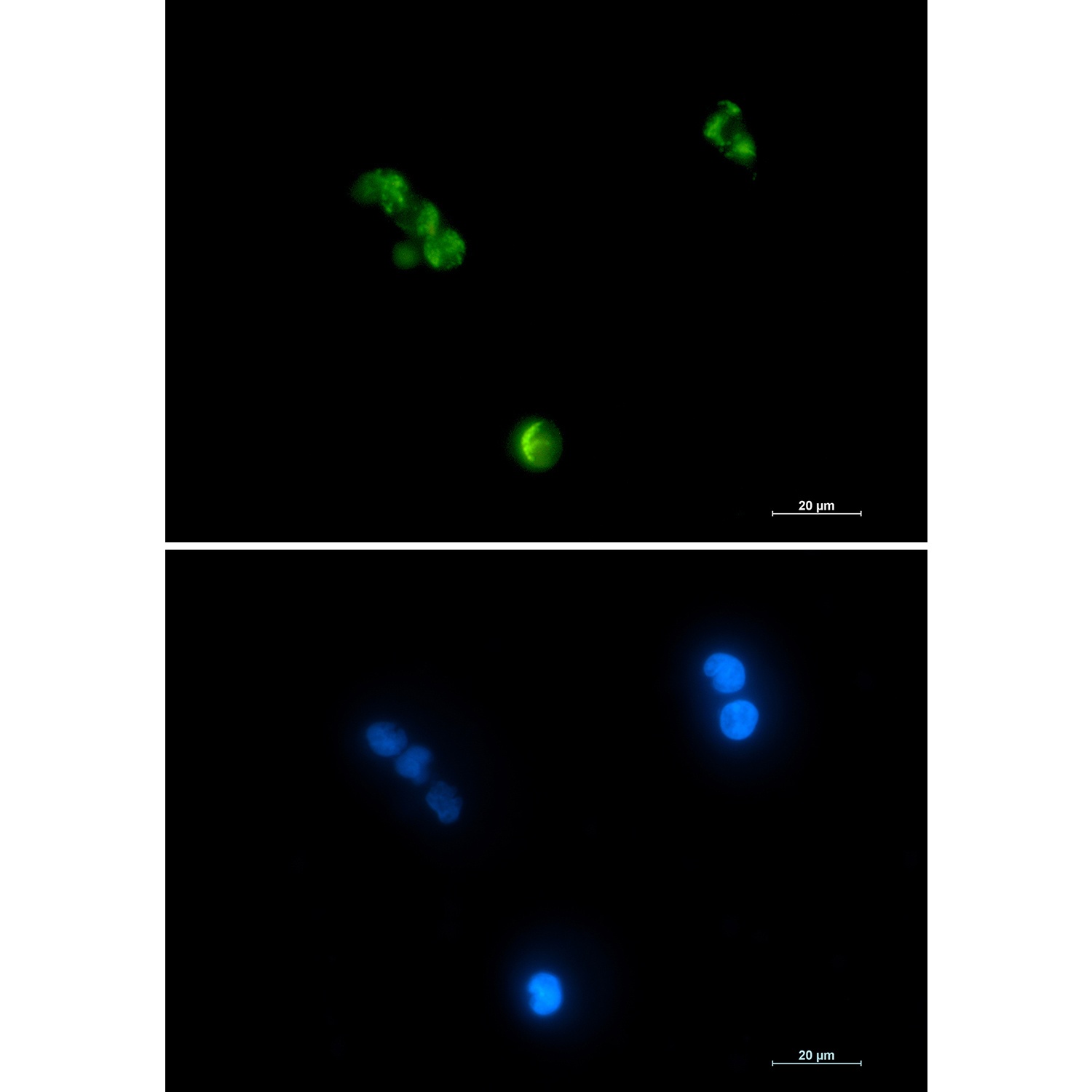 ACO2 Antibody