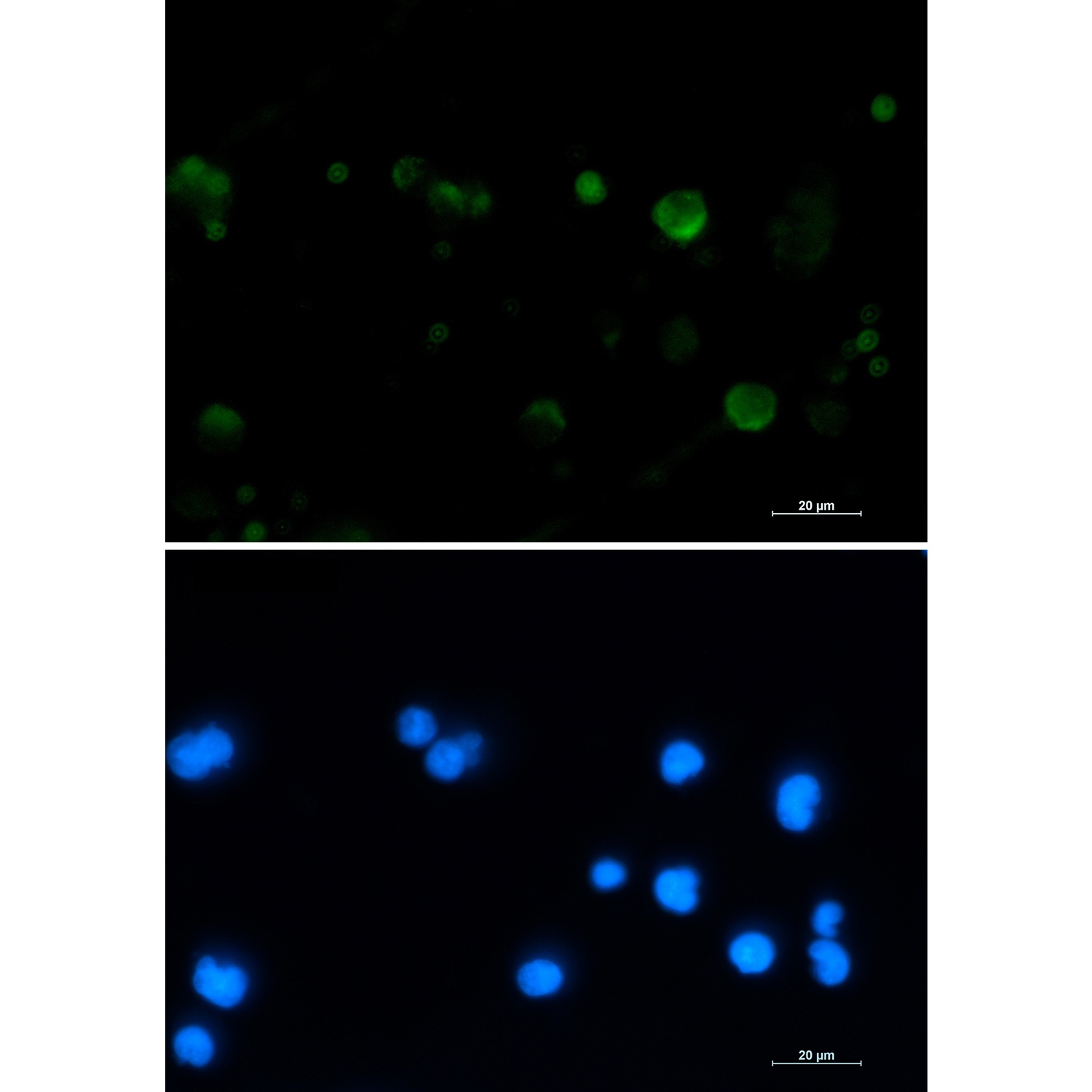 ACO2 Antibody