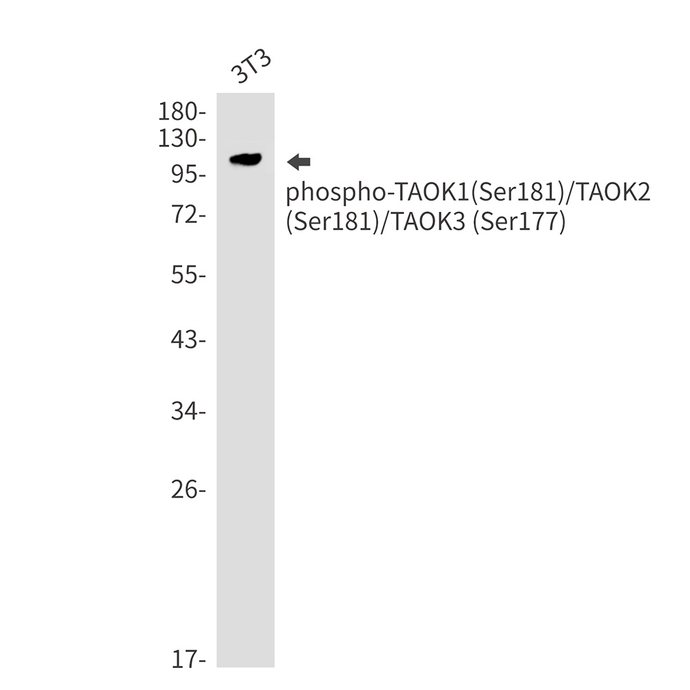 Phospho-TAOK1/2/3 (Ser181/Ser181/Ser177) Rabbit mAb