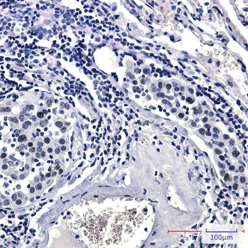 Phospho-Rad17 (Ser656) Rabbit mAb