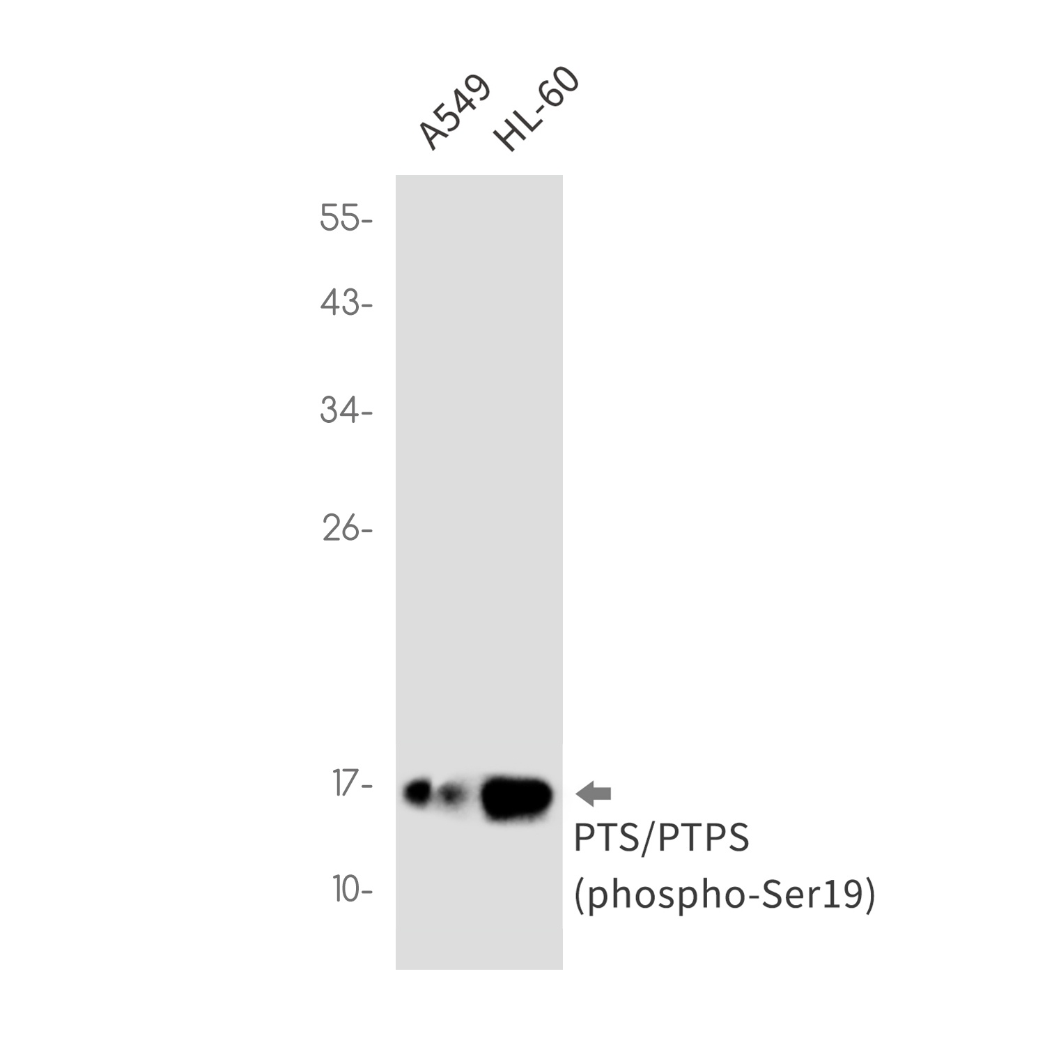Phospho-PTS (Ser19) Rabbit mAb