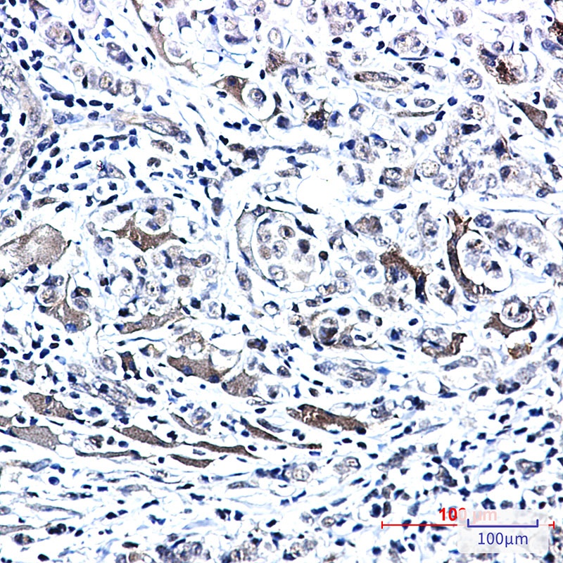 Phospho-PTS (Ser19) Rabbit mAb