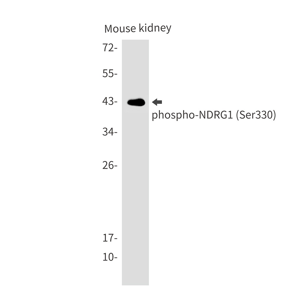 [KO] Phospho-NDRG1 (Ser330) Rabbit mAb