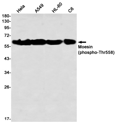 Phospho-Moesin (Thr558) Rabbit mAb