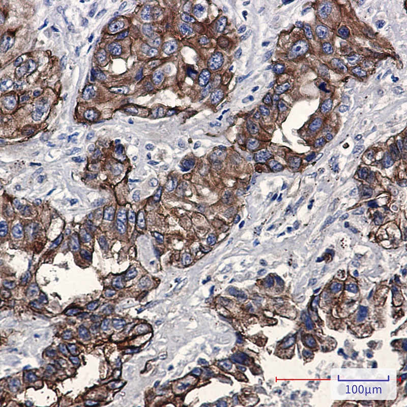 Phospho-Moesin (Thr558) Rabbit mAb