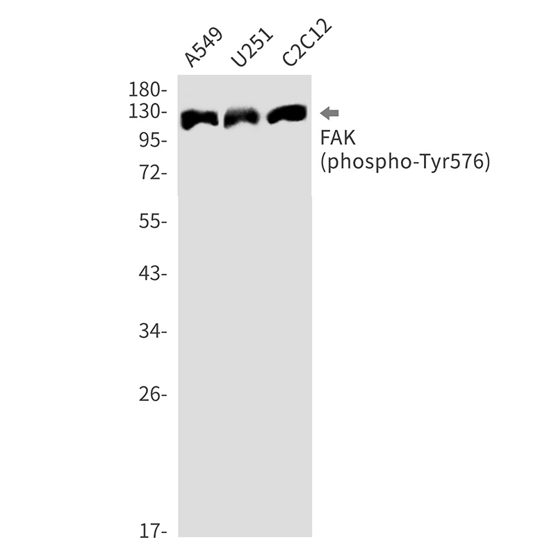 Phospho-FAK (Tyr576) Rabbit mAb