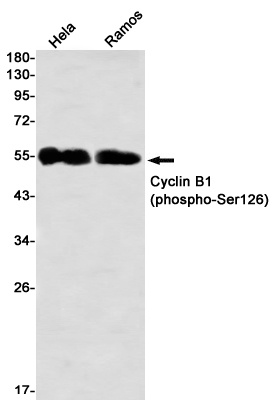 [KD] Phospho-Cyclin B1 (Ser126) Rabbit mAb