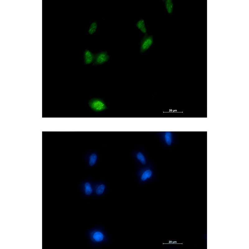 Phospho-Amyloid Precursor Protein (Thr743) Rabbit mAb