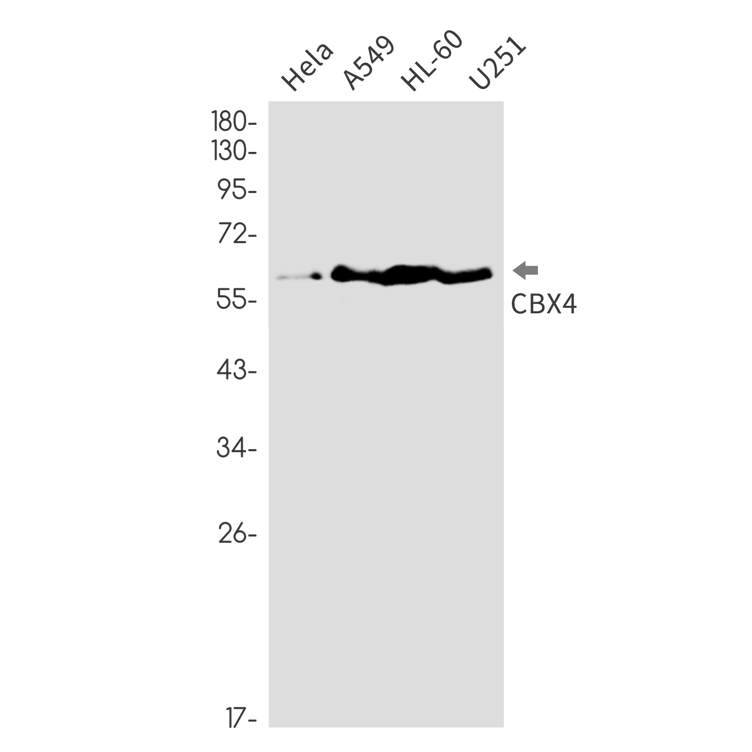 CBX4 Rabbit mAb