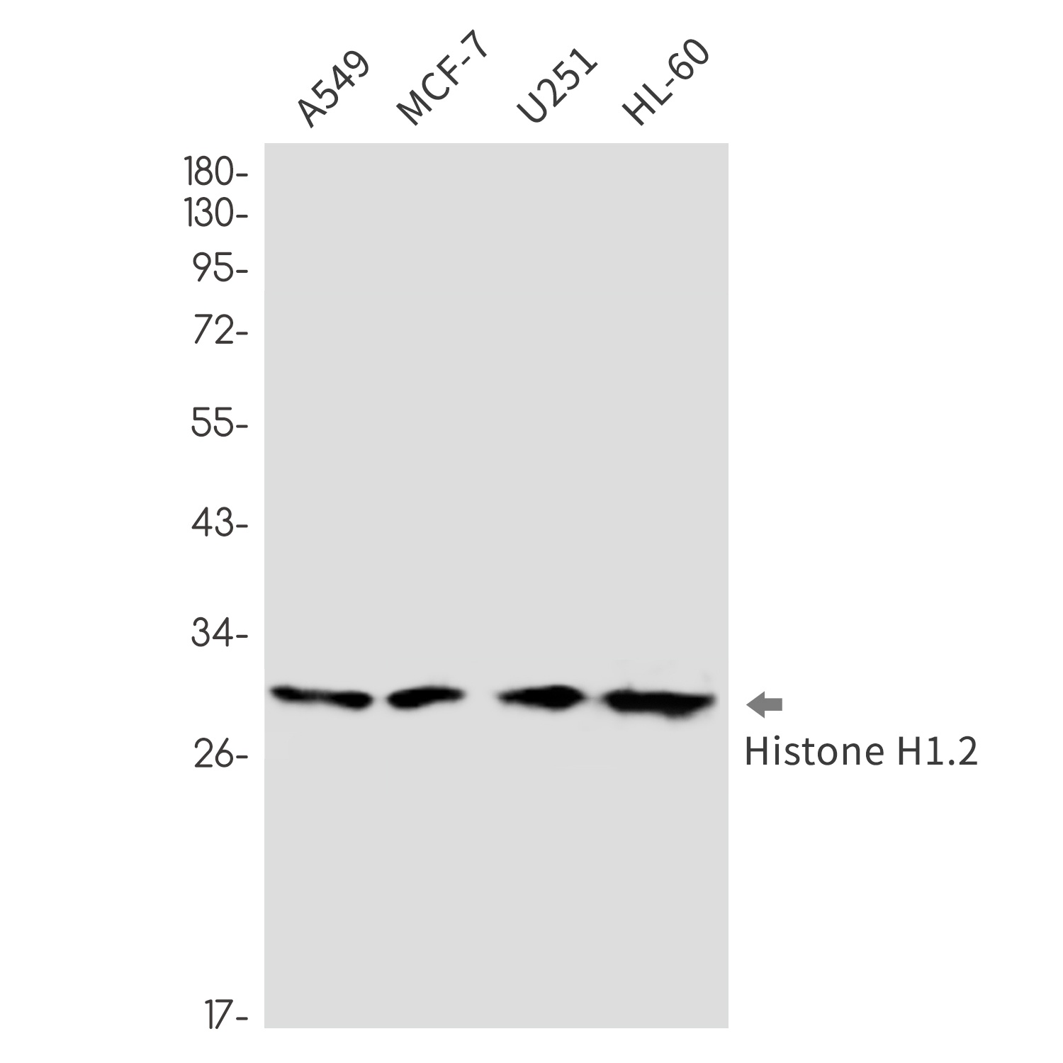 Histone H1.2 Rabbit mAb