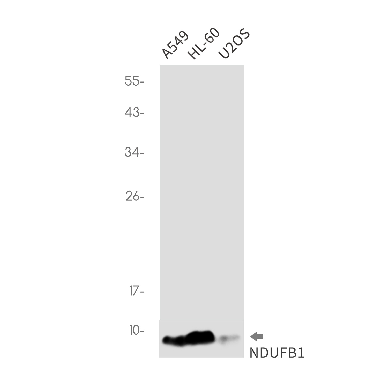 NDUFB1 Rabbit mAb