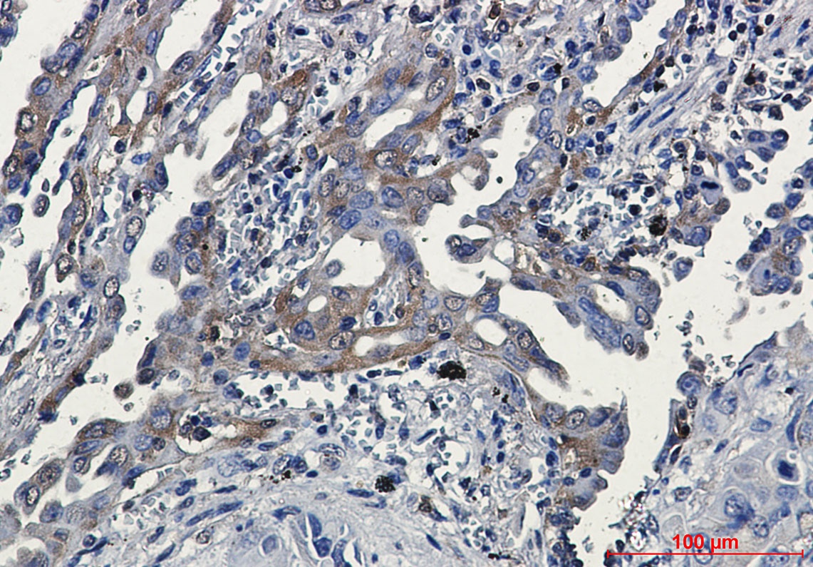 RSK3 Rabbit mAb