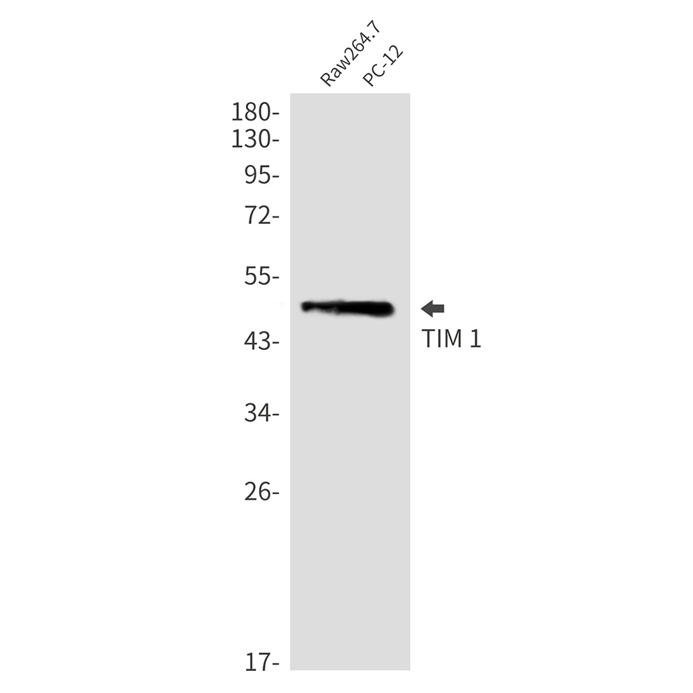 TIM 1 Rabbit mAb