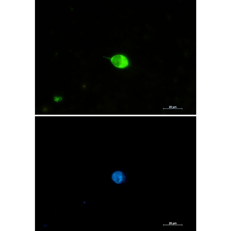 IRF7 Rabbit mAb