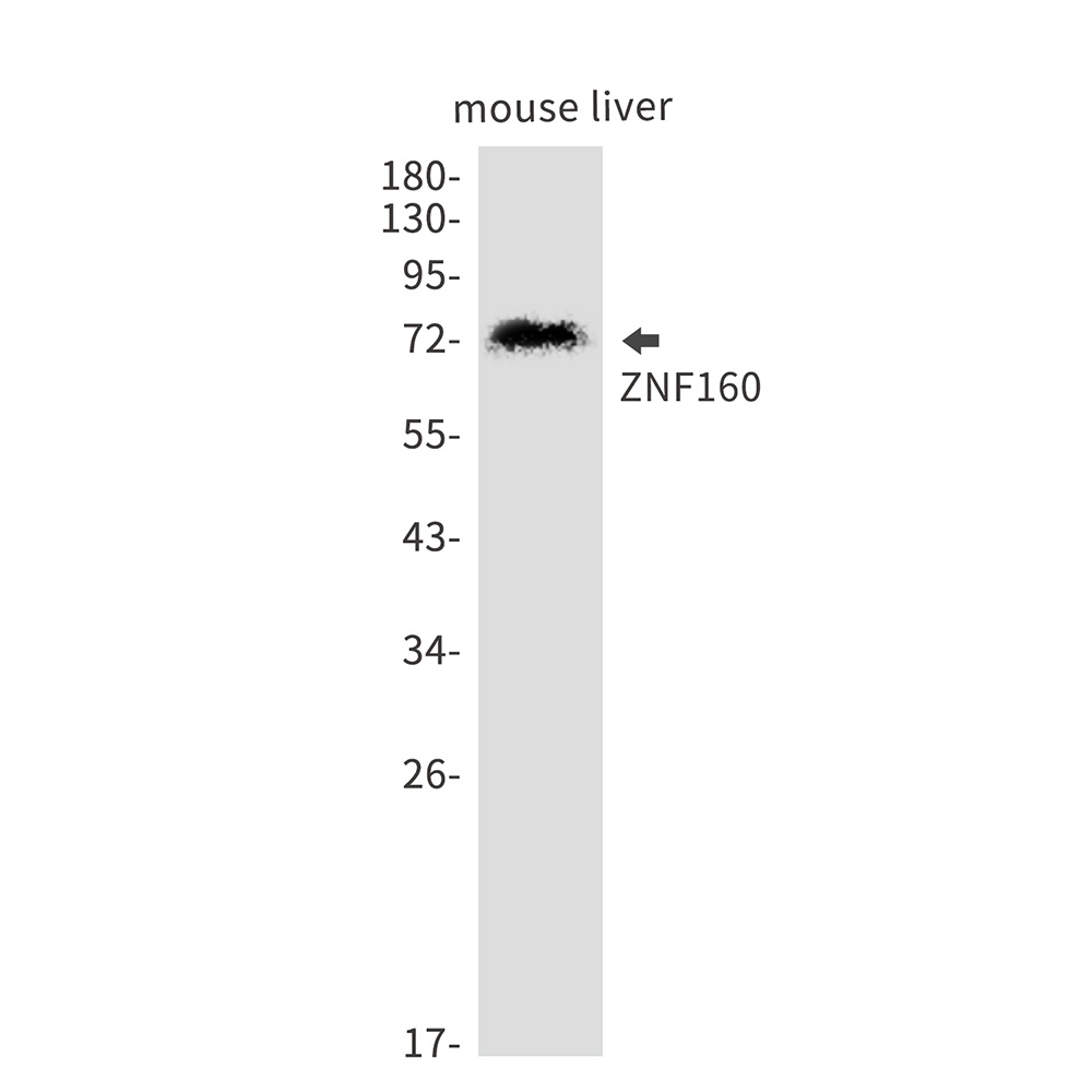 ZNF160 Antibody