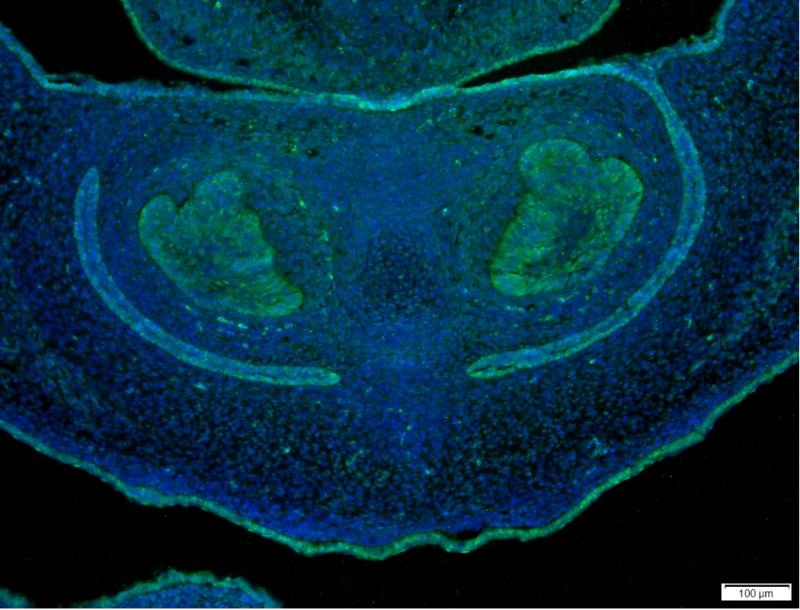 YAP1 Rabbit mAb