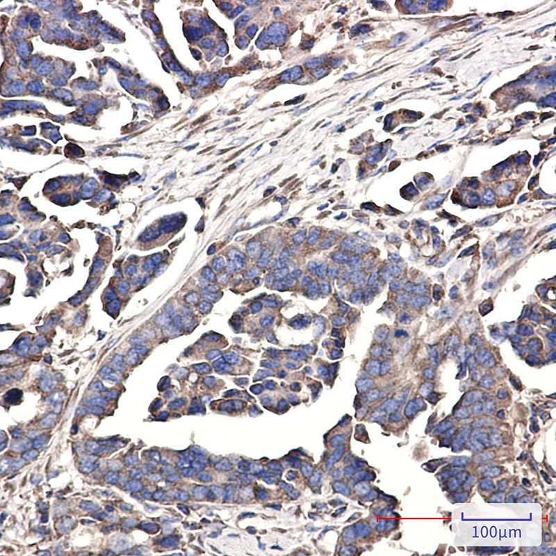 WDR1 Rabbit mAb