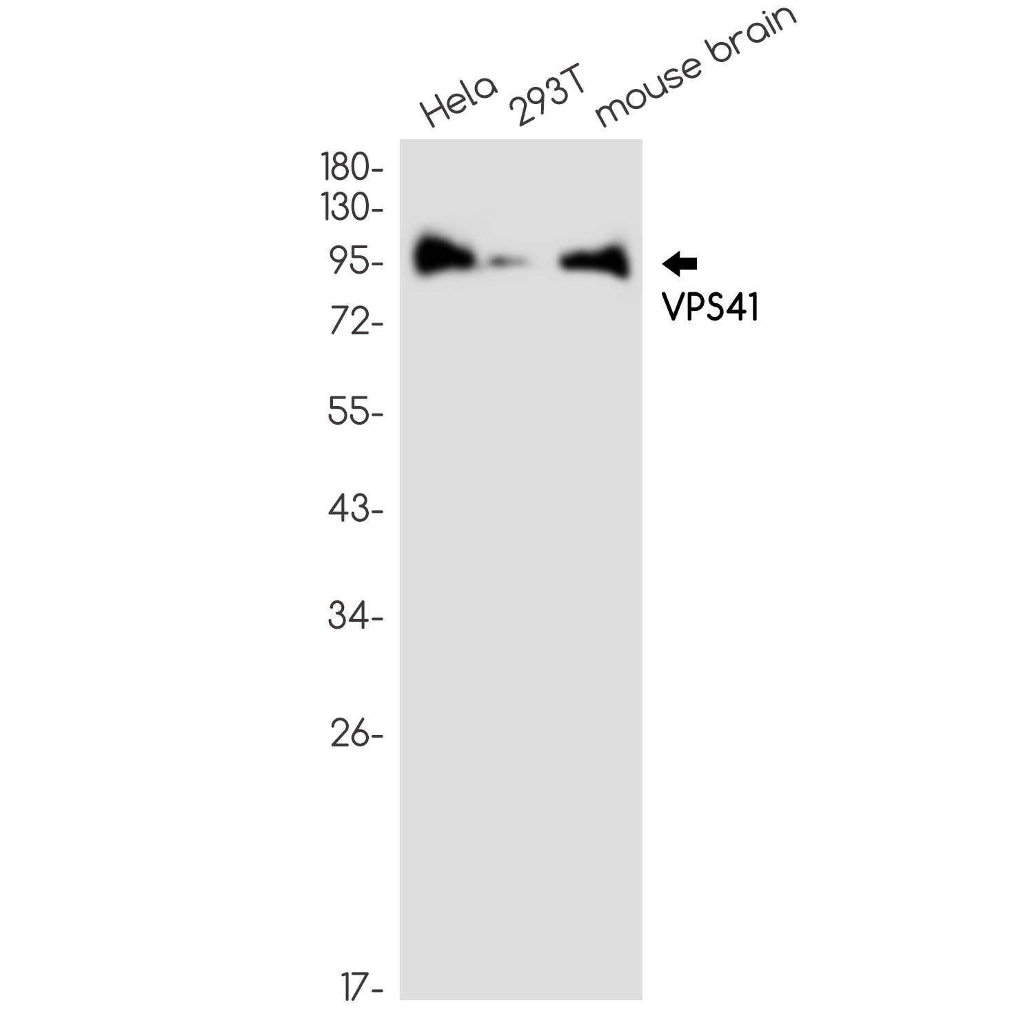 VPS41 Rabbit mAb