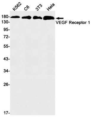 VEGF Receptor 1 Rabbit mAb