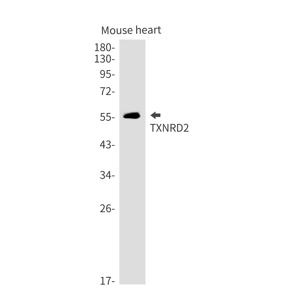 Thioredoxin Reductase 2 Rabbit mAb