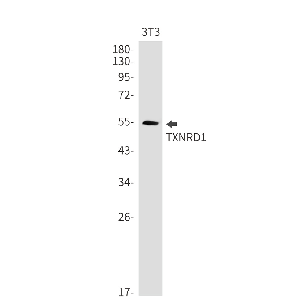 Thioredoxin Reductase 1 Rabbit mAb
