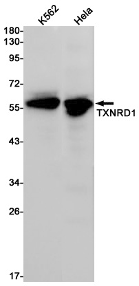 Thioredoxin Reductase 1 Rabbit mAb