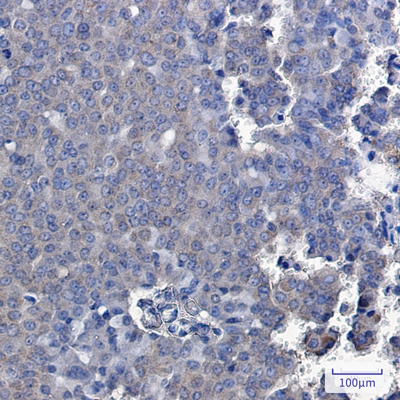 TXNDC9 Rabbit mAb