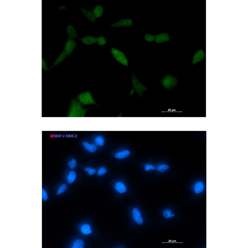 TPPP Antibody