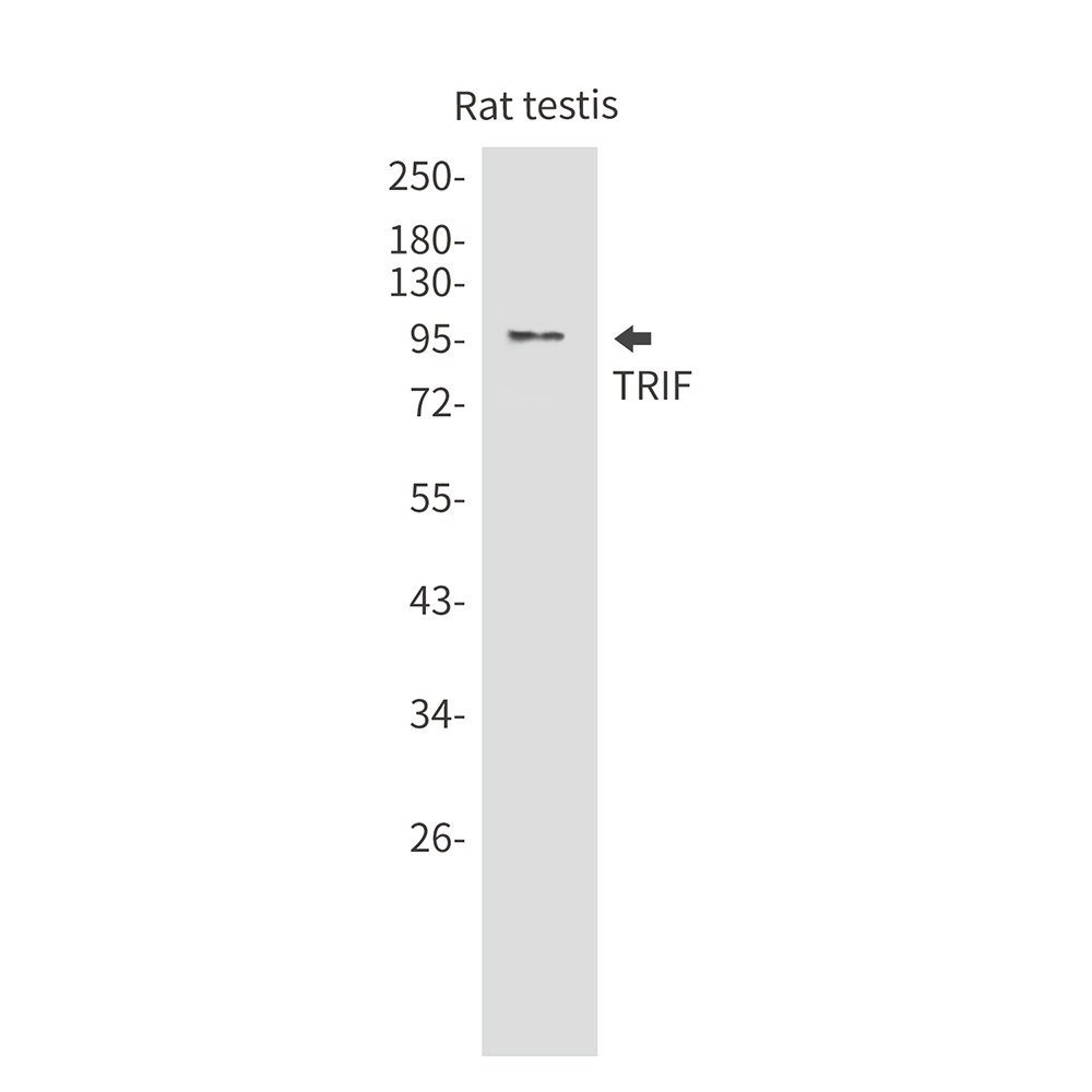 TRIF Rabbit mAb