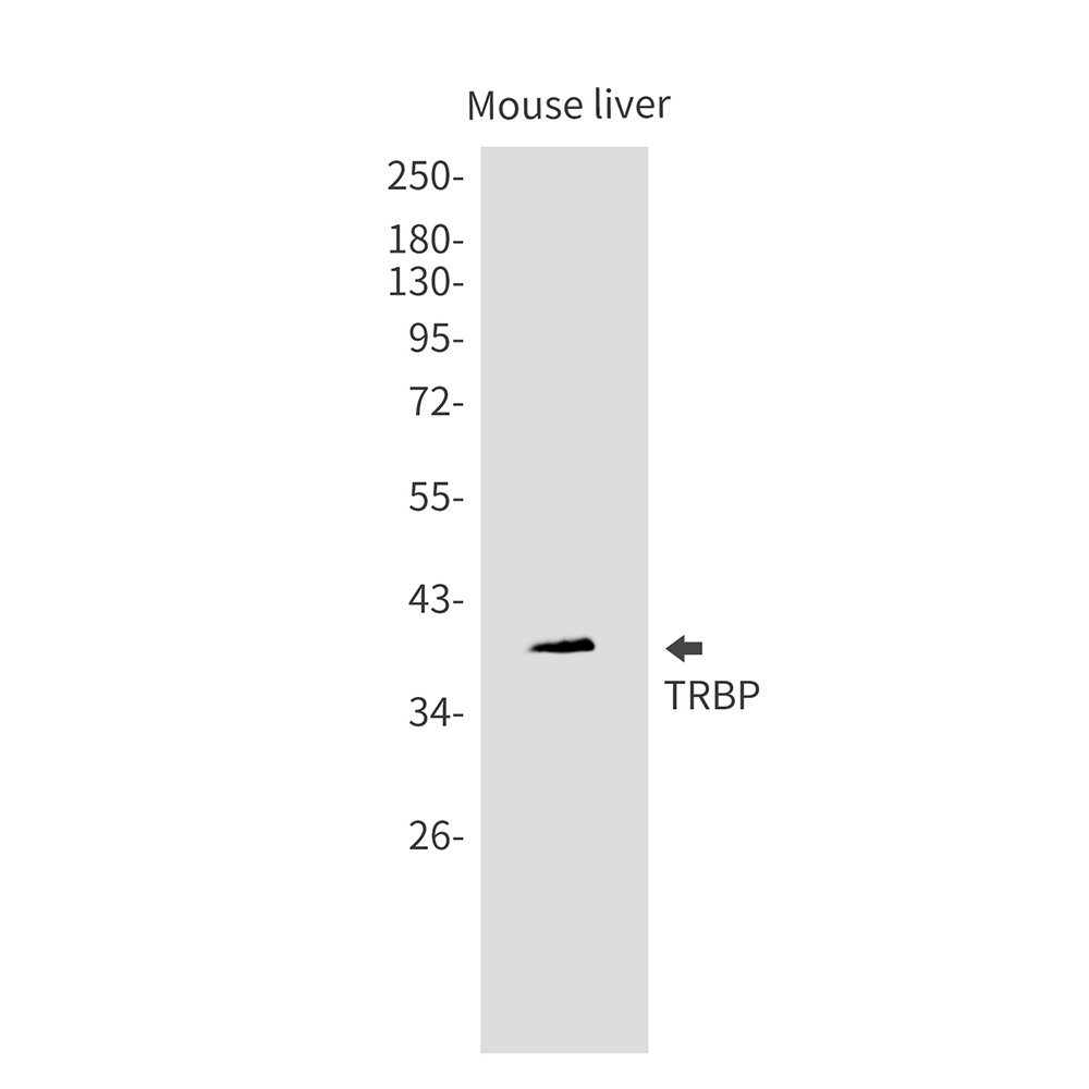 TARBP2 Rabbit mAb