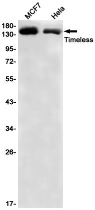 TIMELESS Rabbit mAb
