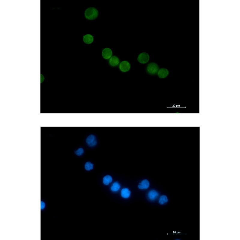 TYMS Antibody