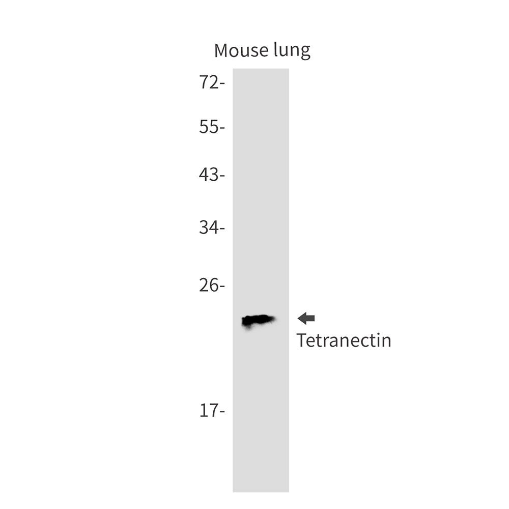 Tetranectin Rabbit mAb