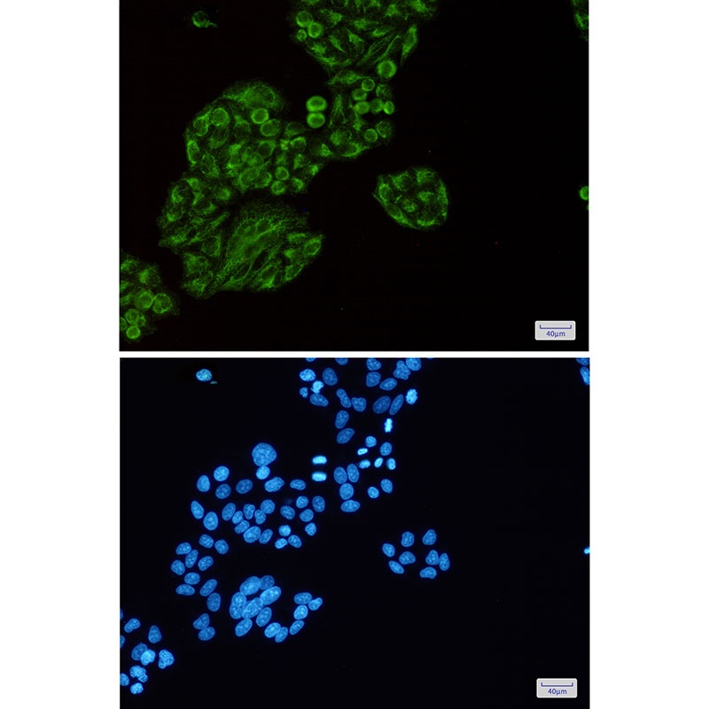 Tec Rabbit mAb