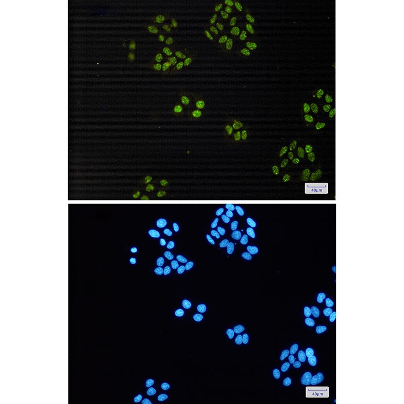 [KO] TAF15 Rabbit mAb