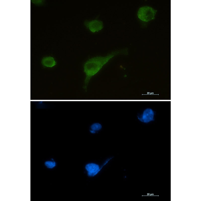 Syntrophin alpha 1 Rabbit mAb