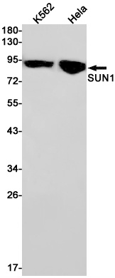 SUN1 Antibody