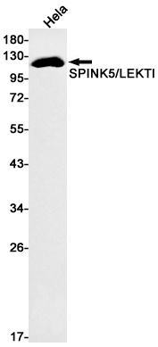 SPINK5 Antibody